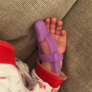 protektor-za-palche-protiv-smuchene-mneniya-3